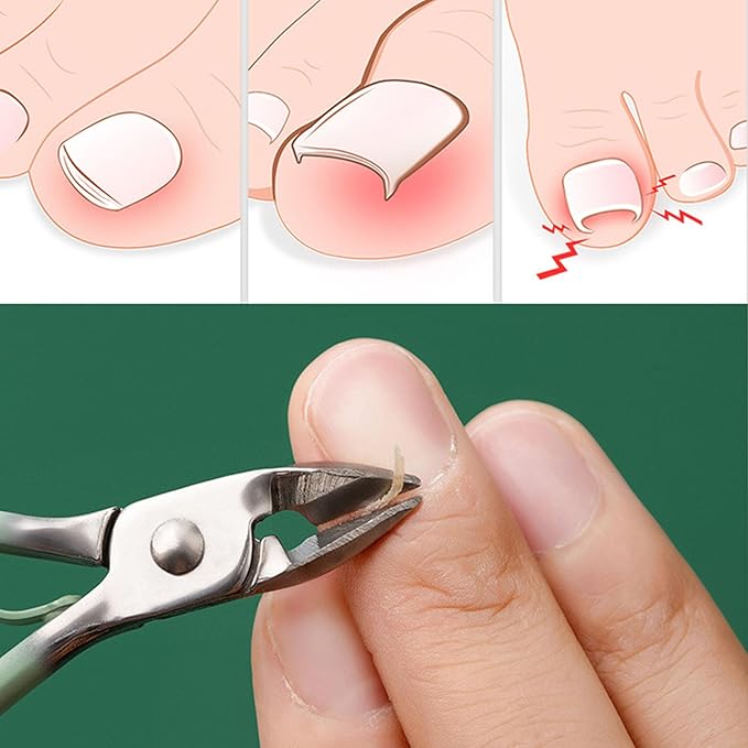 ProCare™ | Die komplette Lösung für professionelle Nagelpflege