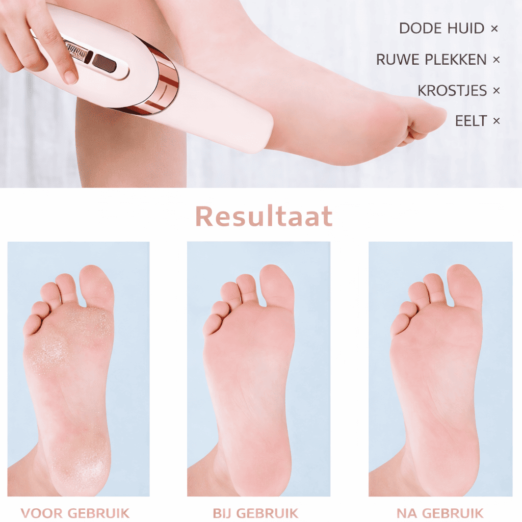 PediCare™ | Pflegen Sie Ihre Füße ganz einfach zu Hause.